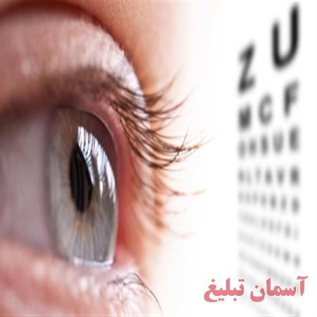 دانلود نمودار یوزکیس مورد کاربرد مطب چشم پزشکی